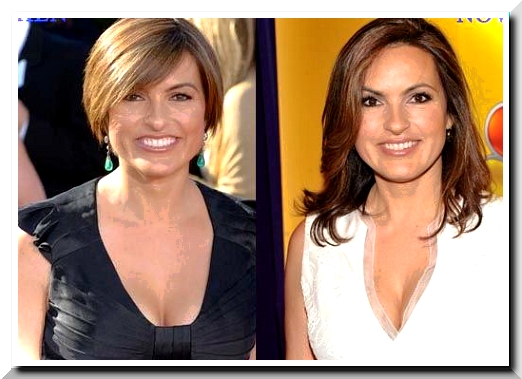 Mariska Hargitay Rumors on Plastic Surgery