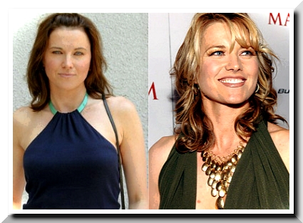 Lucy Lawless Plastic Surgery – Was it a fake beauty?