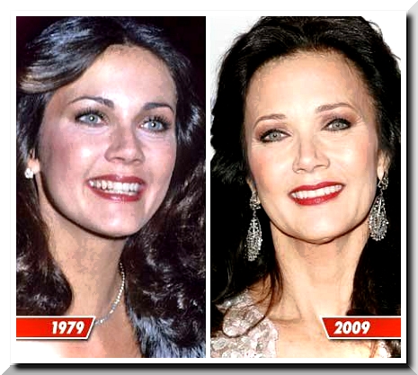 Did Lynda Carter Have Plastic Surgery?