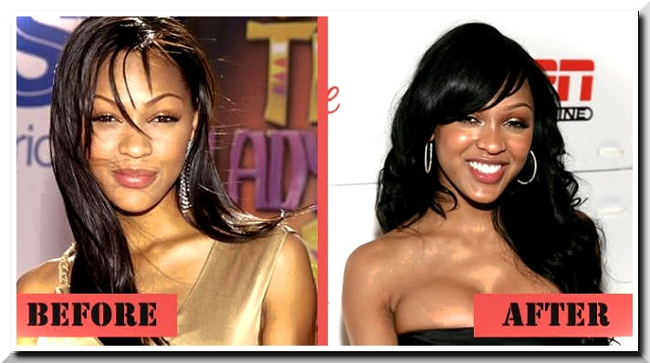 Did Meagan Good really have the Plastic Surgery?